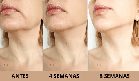 SKINSCULPT™