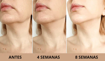 SKINSCULPT™