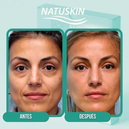 Natuskin™ – Parches de Colágeno